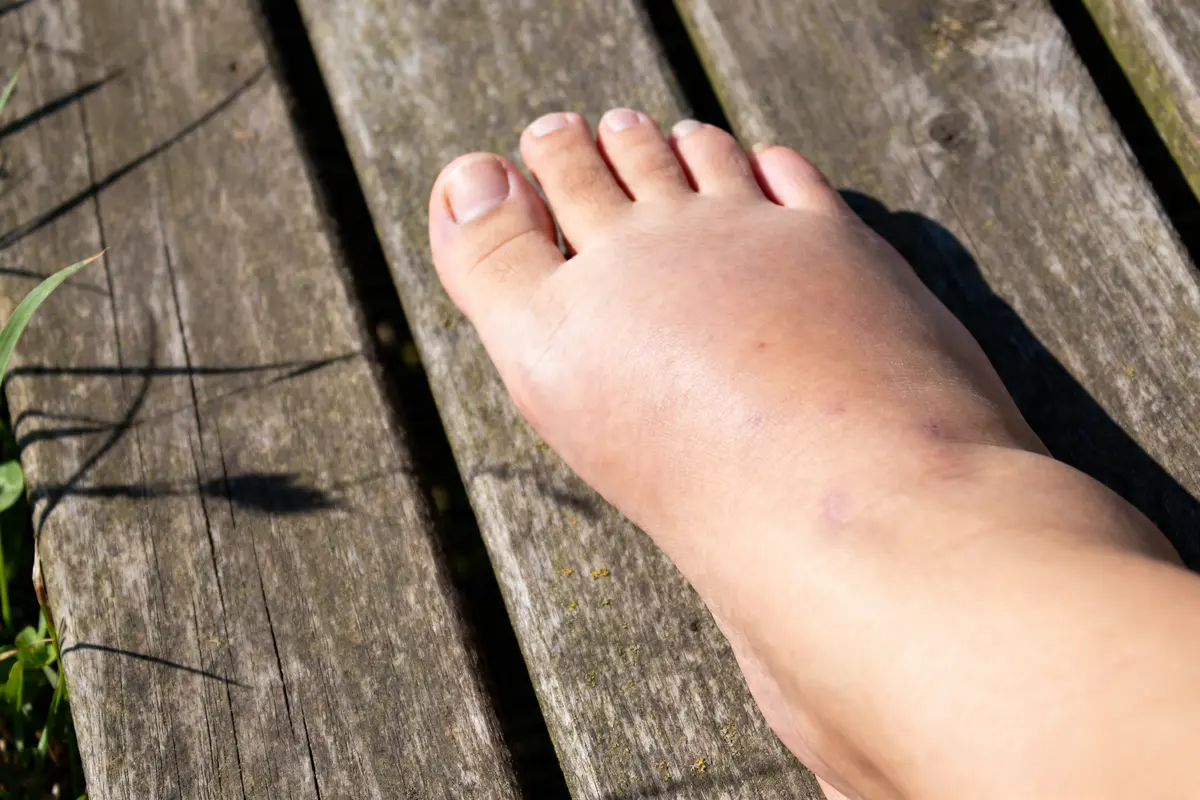 Dessus du pied gonflé reposant sur une surface en bois à l'extérieur