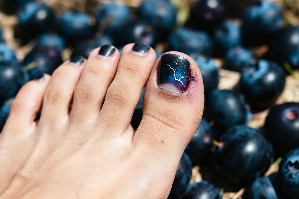 pexels-michal-pech-213601-757318 (1) Pied avec ongle noir décoré, entouré de fruits noirs dans la nature